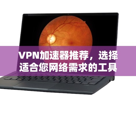 VPN加速器推荐,选择适合您网络需求的工具